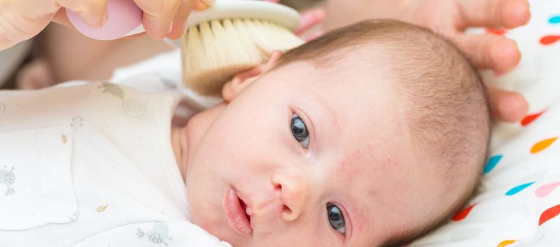 Bebeklerde Konak Nedir Neden Olur Nasil Tedavi Edilir Bebekbakim Net