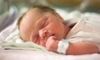 Bebeklerde Sarılık Belirtileri, Nedenleri ve Tedavisi